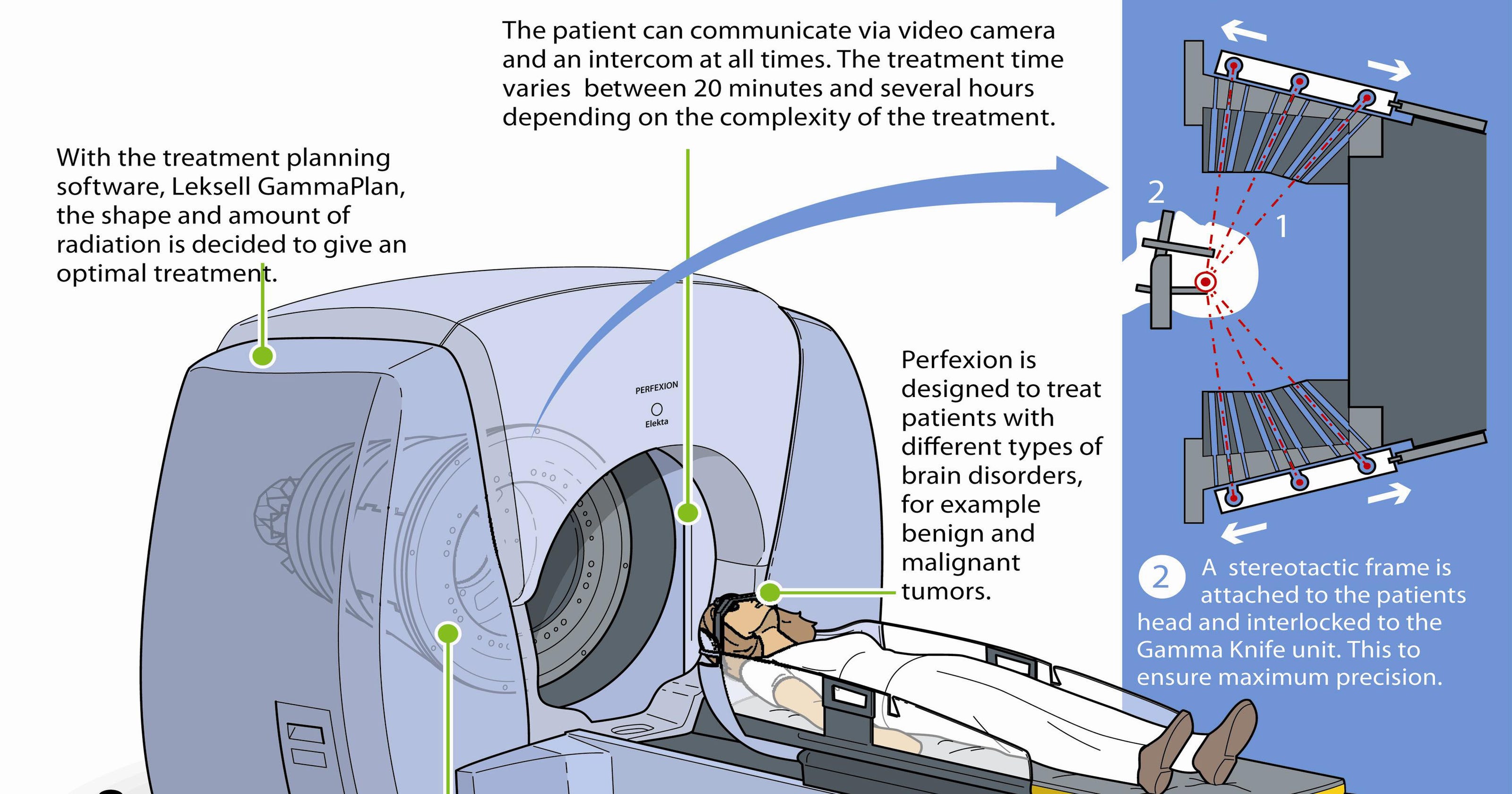 Avera's 'Gamma Knife' a new way to treat cancer