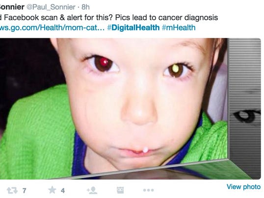 An Illinois mom discovered that her son had eye cancer after snapping