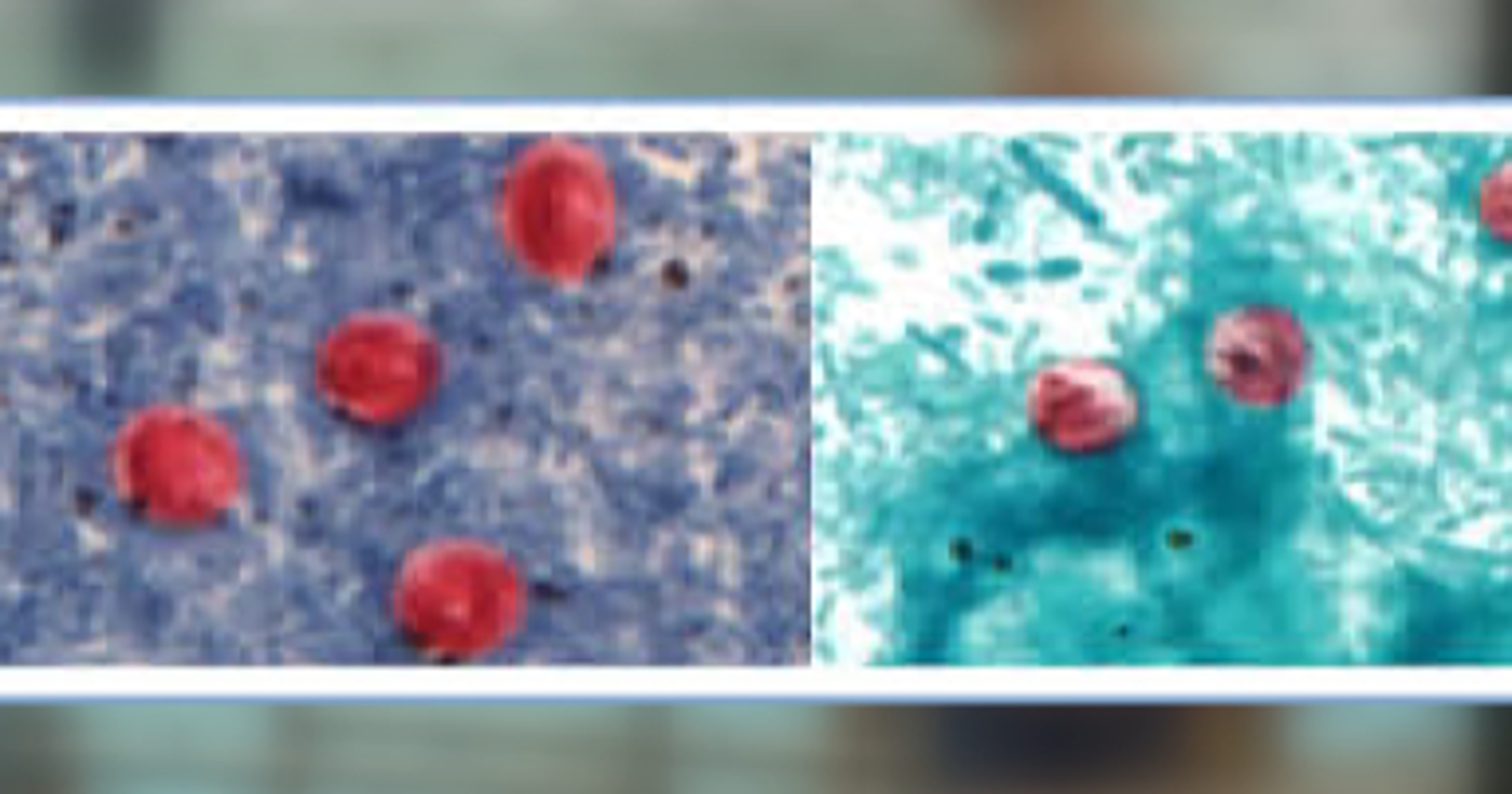 Is This Parasite Behind Your Cryptosporidiosis? (Find Out Now!) - j2c5rxc