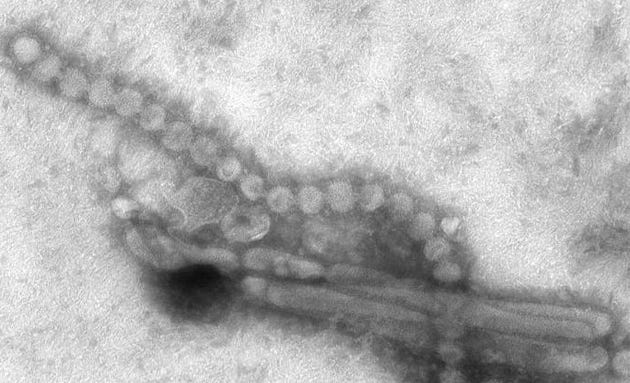 H7N9 influenza virus_CDC image