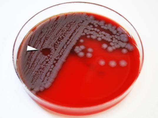 XXX ANTHRAX-BACTERIA07.JPG