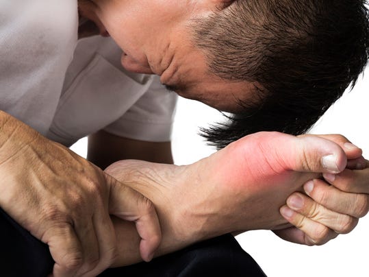 ... disease among people who had gout. (Photo: Getty Images/iStockphoto