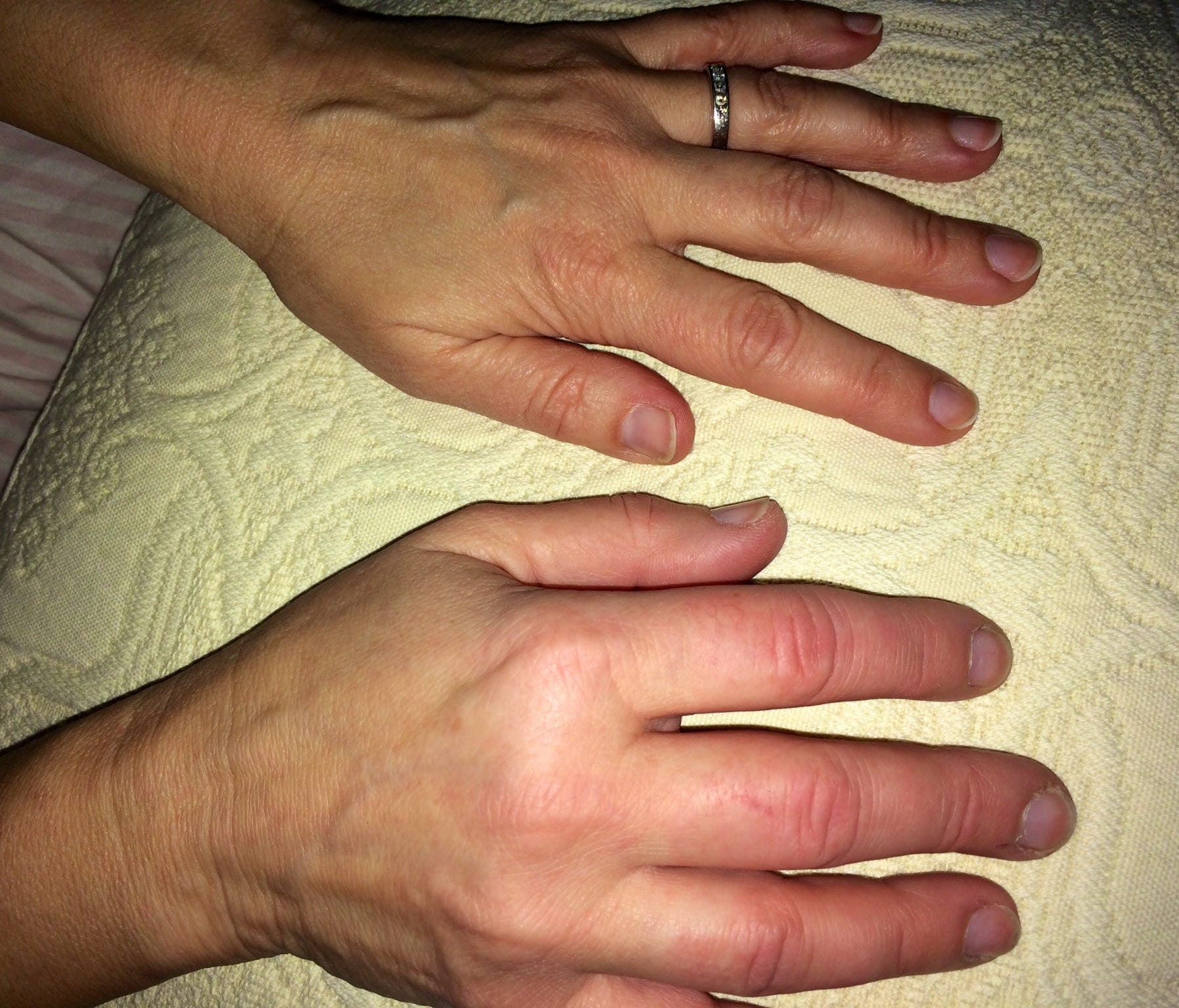 Woman stung by scorpion on plane: 'hand is still numb' | wtsp.com