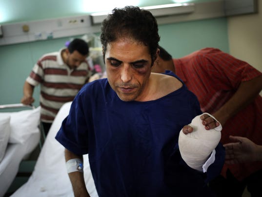 LOL, stabbed Egyptian politician decries violence 0e1168ff917658213f0f6a70670031b0