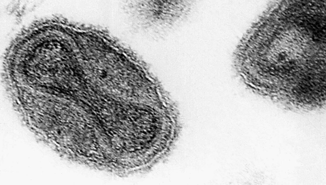 vials of smallpox found near D.C.