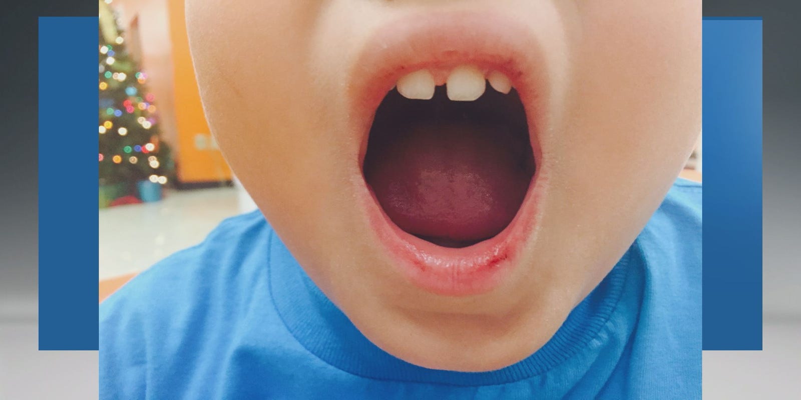Mom Ymca Worker Duct Taped My Sons Mouth Closed 