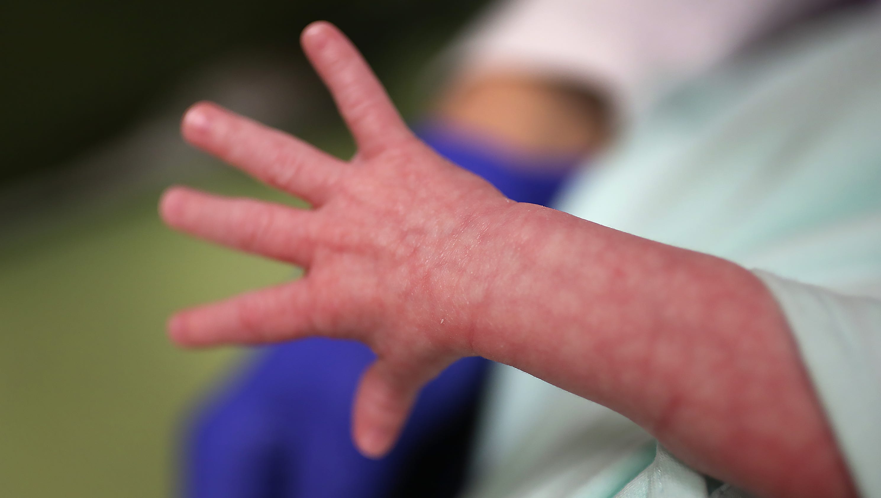 Babies born with heroin dependency