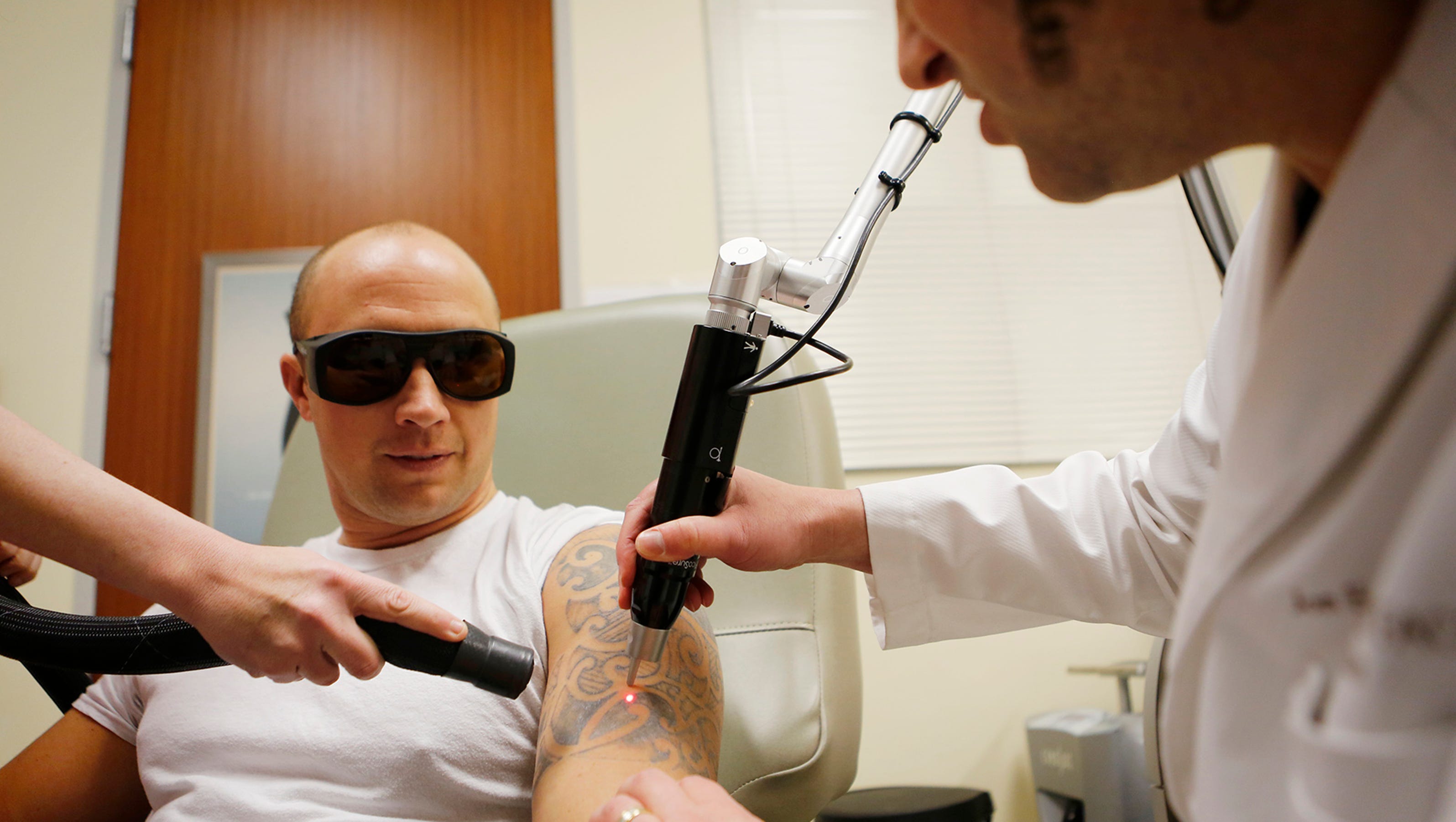 Tattoo removal takes laser leap forward