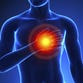 Many middle-aged men who had sudden cardiac arrests had symptoms beforehand.