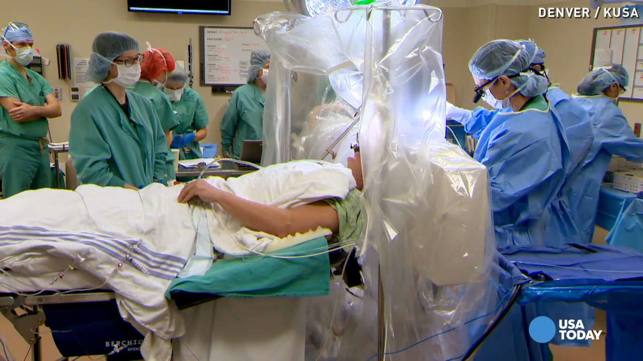 Take an inside look at life-changing brain surgery