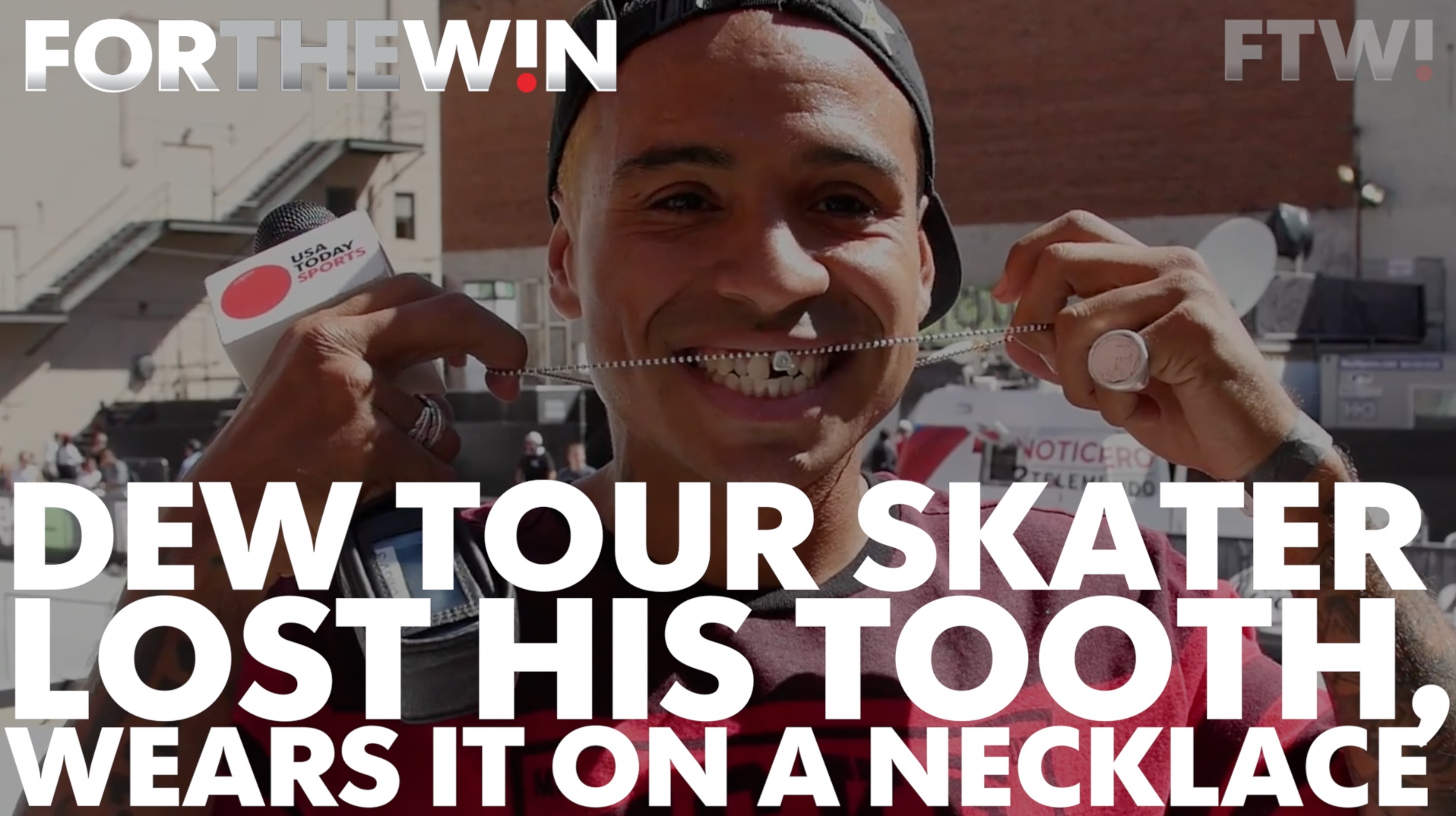 Dew Tour skater lost tooth, now wears it on a necklace