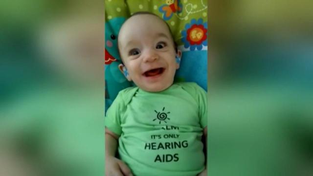 Baby uses hearing aids for the first time