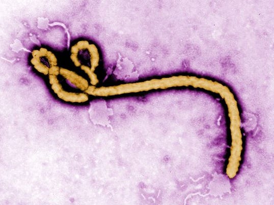 1409355045000-Ebola.jpg