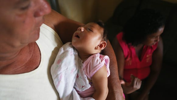 Alice Vitoria Gomes Bezerra, 3-months-old, who has