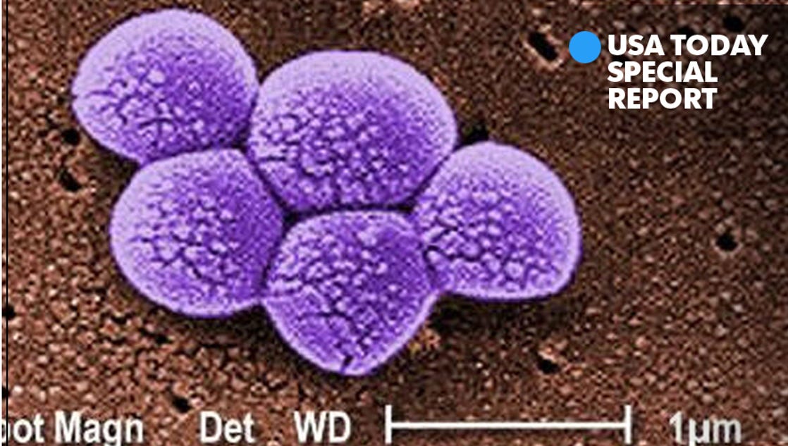 MRSA Bacteria | MRSA Photos | Community | MRSA | CDC