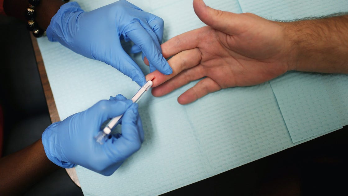 CDC report 1 in 8 Americans with HIV don't know they have the virus