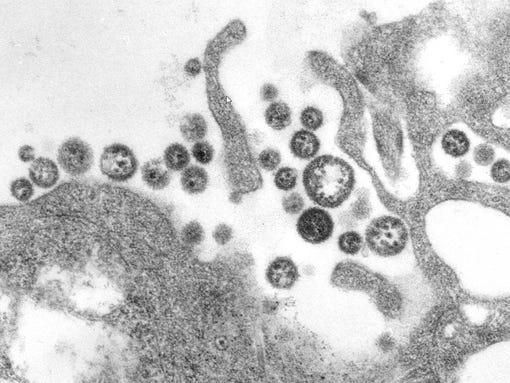 Lassa virus virions_CDC image