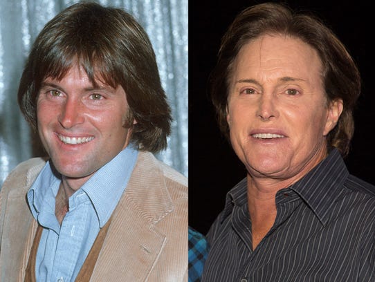 bruce jenner before and after