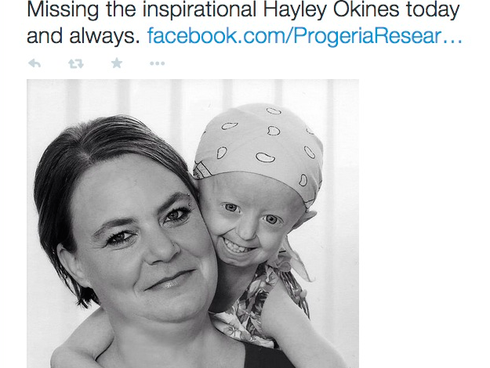 Hayley Okines died Thursday at age 17.