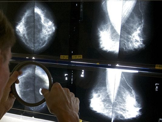 Mammograms