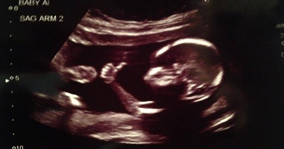 Baby gives thumbsup in ultrasound photo