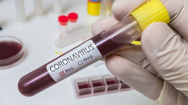 Tube of blood marked positive for coronavirus