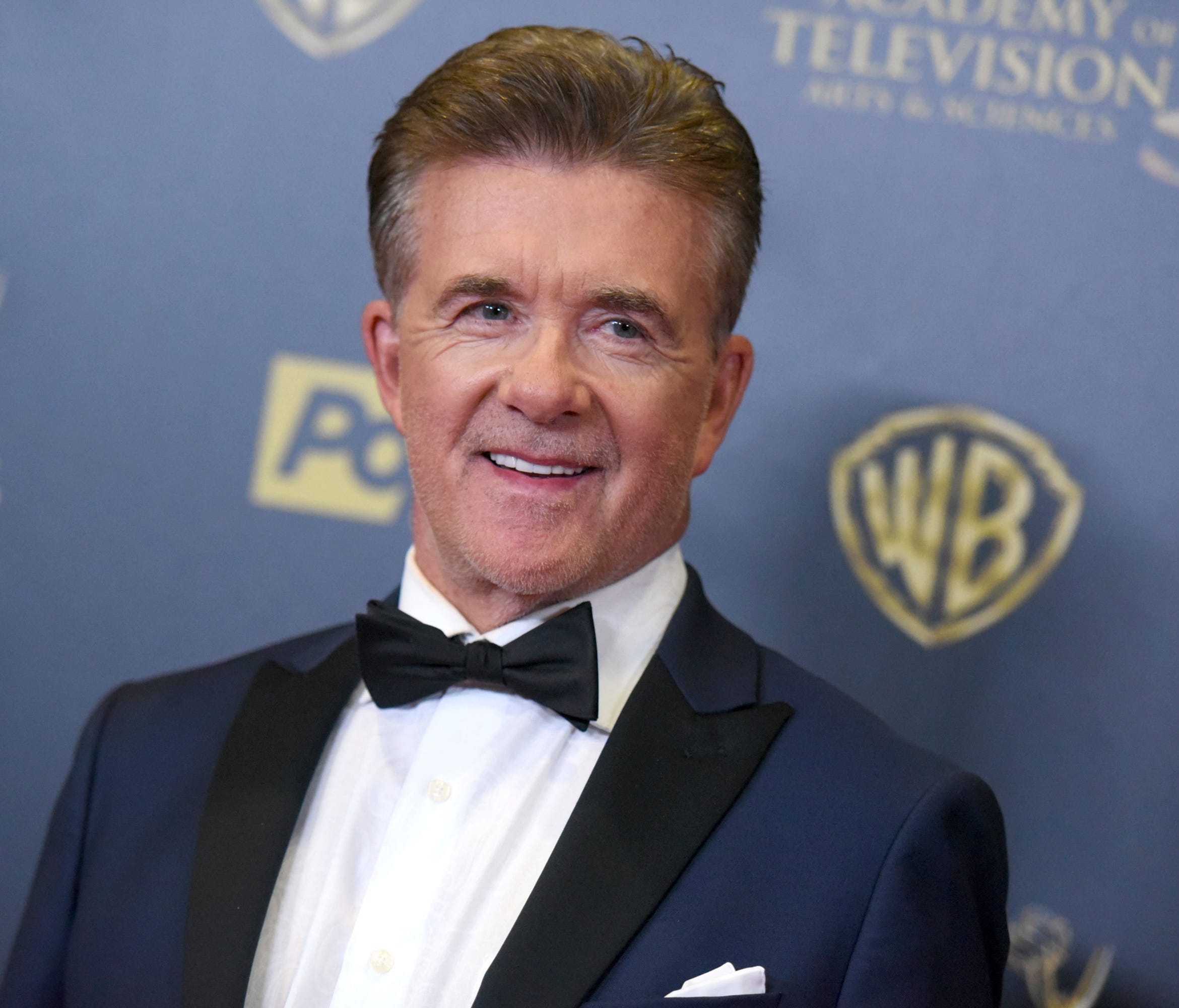 'Growing Pains' star Alan Thicke died of a ruptured aorta, his death certificate stated Wednesday.
