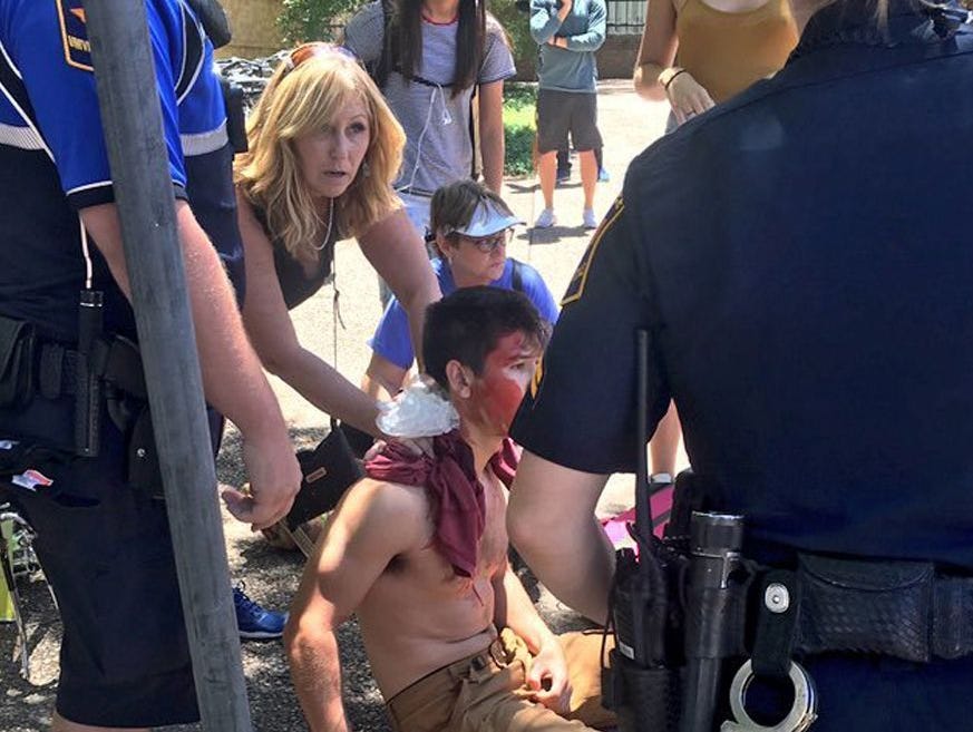 A person is treated by first responders after a deadly stabbing attack on the University of Texas campus in Austin, Texas on May 1, 2017.