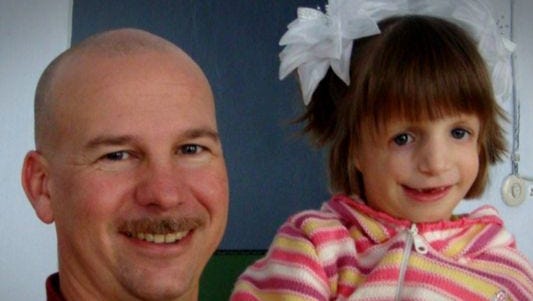 Girl Born Without A Face Finds Sister Across The World