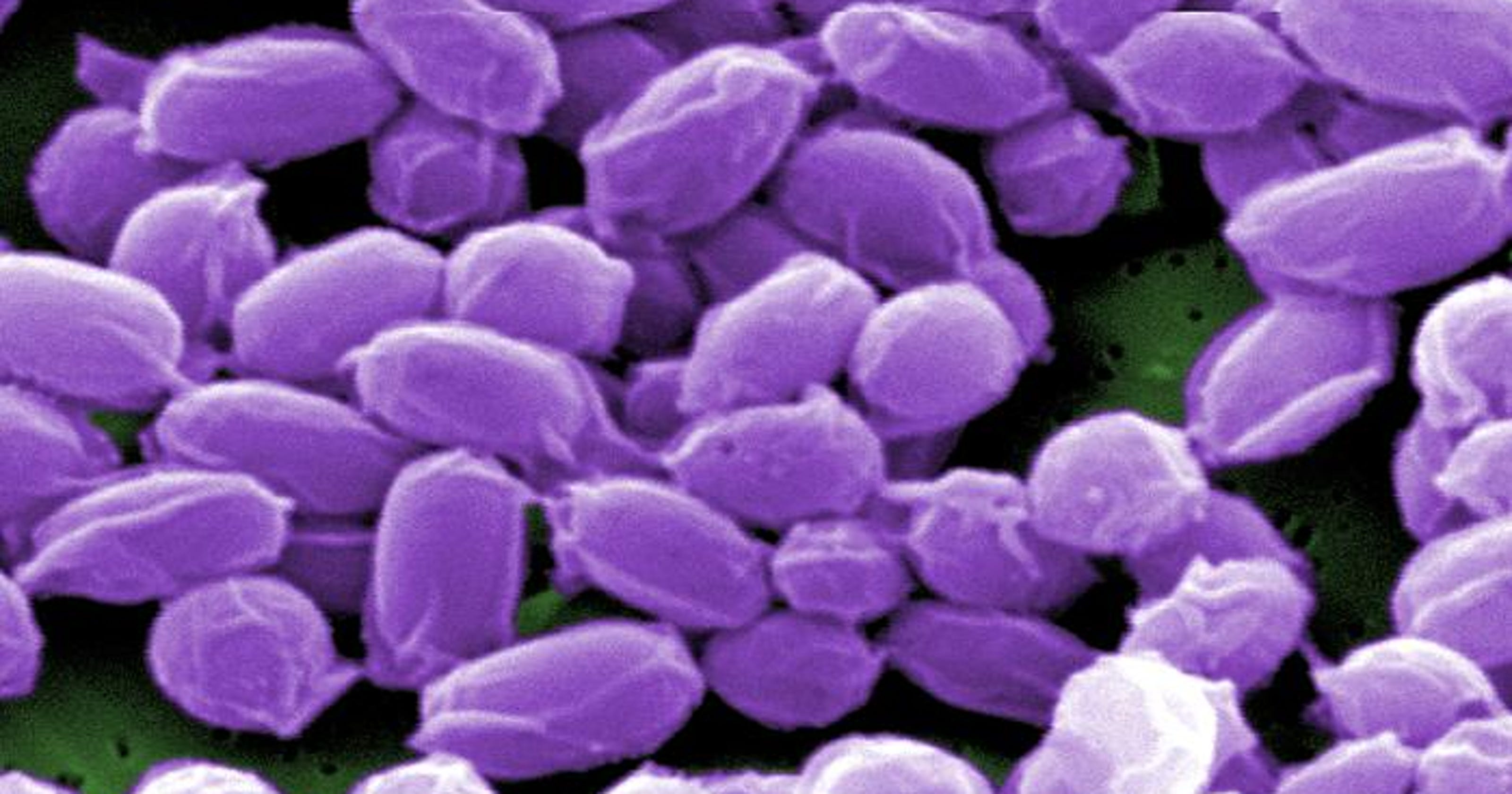 Army lab lacked effective anthrax-killing procedures for 10 years
