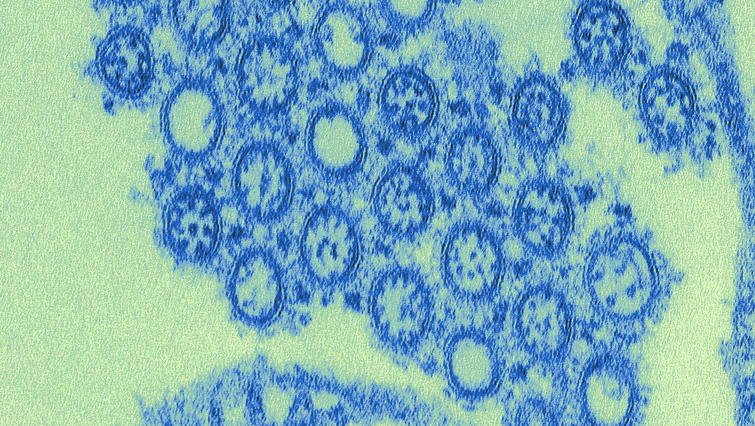 'Typical' flu season brings five deaths to Ventura County