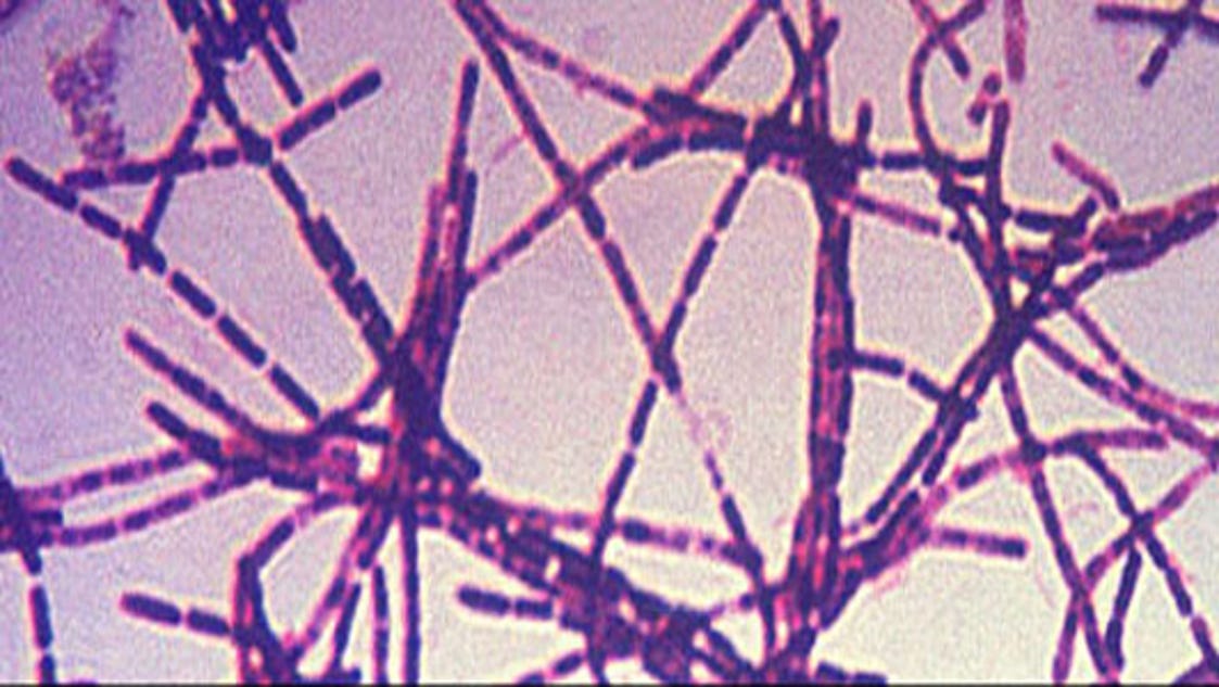 Anthrax scare is latest safety lapse at CDC labs