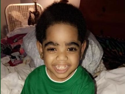 A.J. Burgess, 2, who was born without kidneys, was hospitalized Sunday, Oct. 29, 2017, after he was denied a transplant from his father whom the family say is a perfect match.