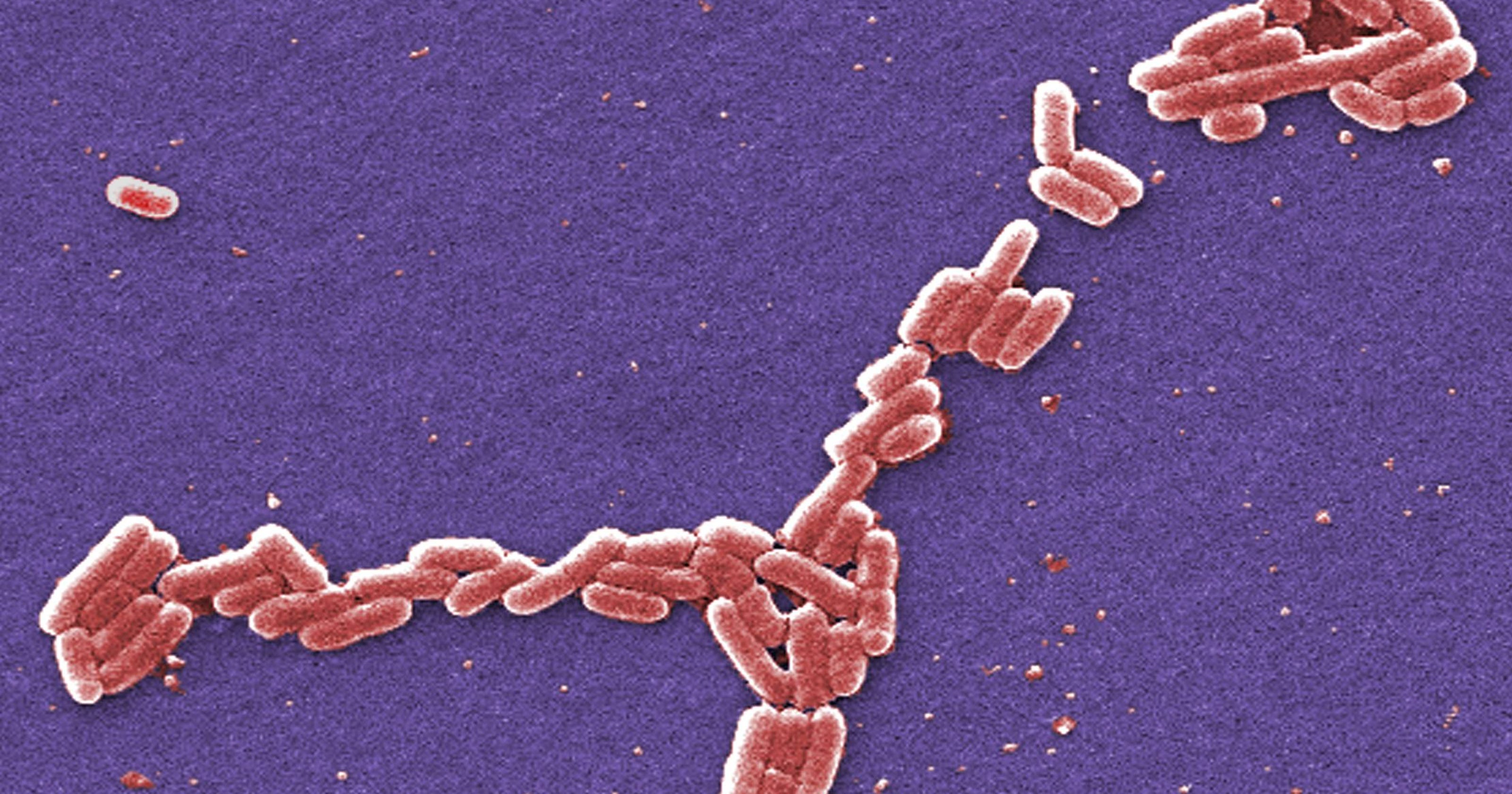 Good practices limit E. coli spread in lettuce fields