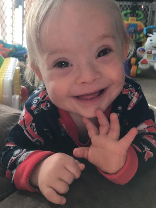 First baby with Down syndrome wins Gerber baby of the year