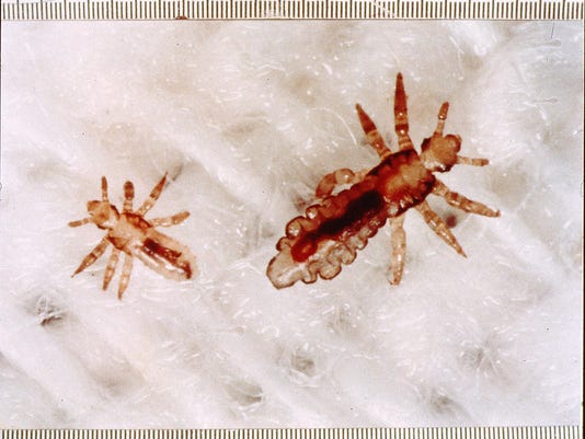 It's a bird, a plane ... it's Super Lice in your kid's hair