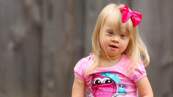 Girl with Down syndrome changing face of modeling