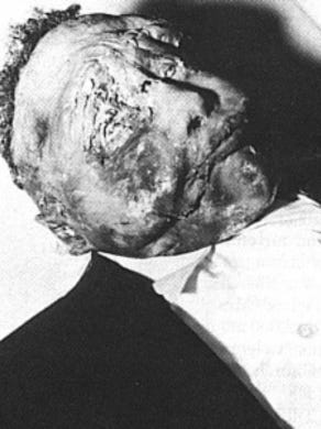 emmett beaten murdered burial disfigured