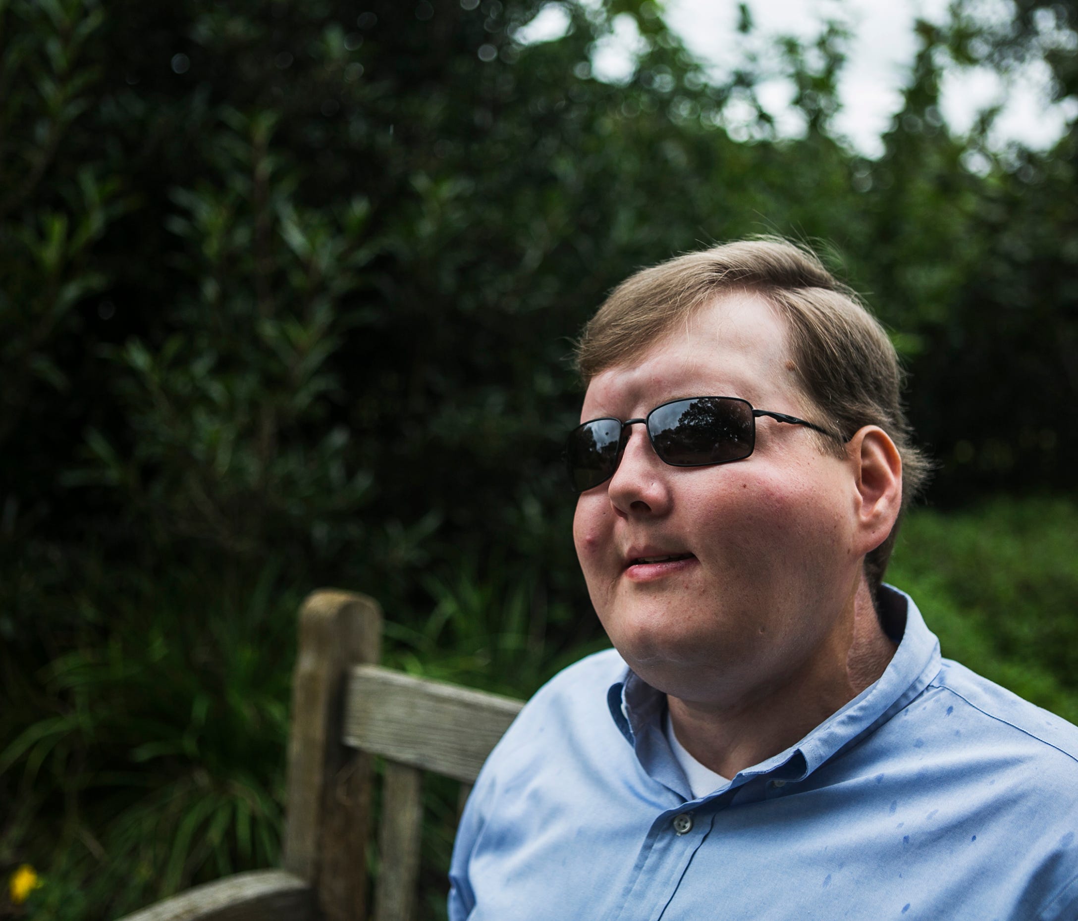 October 22, 2017 - Face transplant recipient Pat Hardison, 43, poses for a portrait prior to speaking at the Mid-South Transplant Foundation's annual 