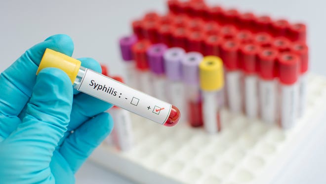 Syphilis blood sample