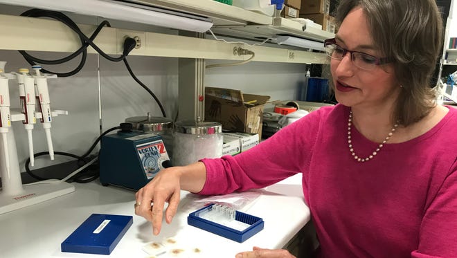 Sanford Research's Kristi Egland, Ph.D., goes through lab samples of her breast cancer tumor.
