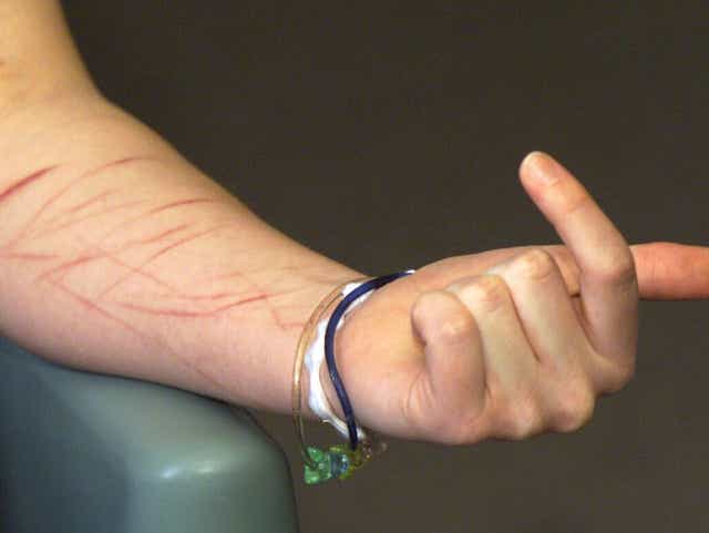 Social Media Is One Reason My Teen Patients Are Cutting Themselves