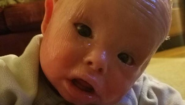 Jamison Spam's 1-year birthday was monumental for...