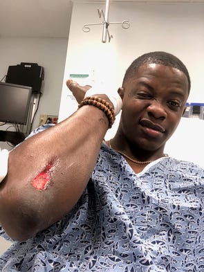 James Shaw Jr. shows injuries he received when he stopped