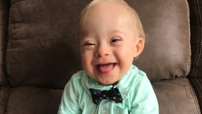 Lucas Warren is the first Gerber baby contest winner (2018) to have Down syndrome. Credit: Screen grab from the TODAY show on Feb. 7, 2017.  Credit: Cortney Warren/Gerber
