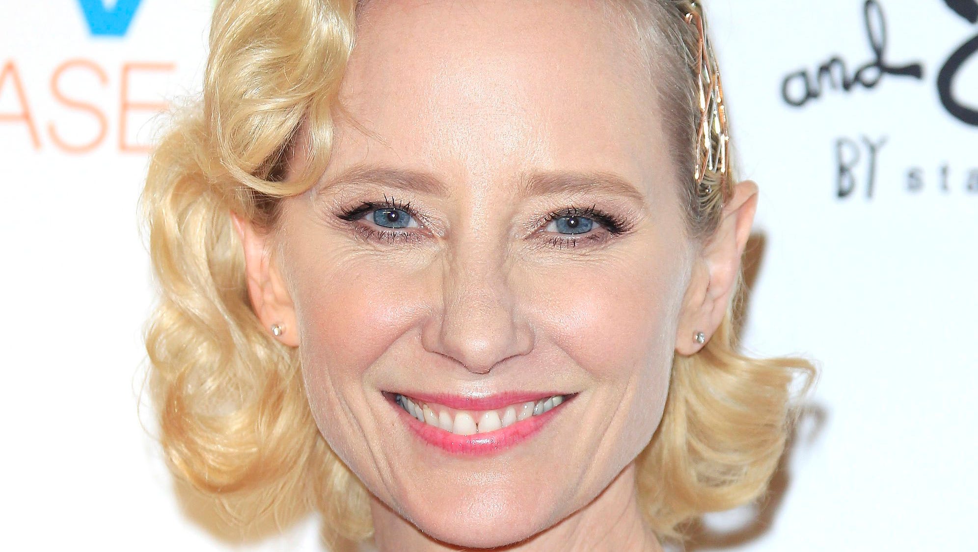 Anne Heche hospitalized in ‘stable’ condition after fiery car crash in Los Angeles