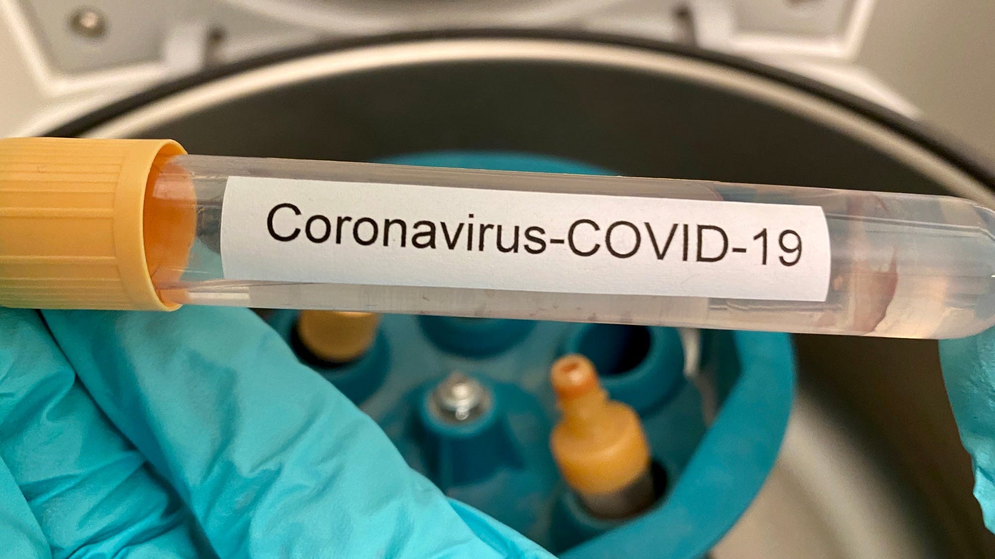 United Kingdom coronavirus strain found in Westchester County NY