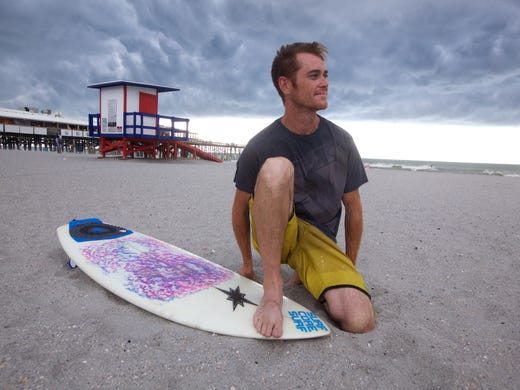  Bobby Baughman was bit by a shark in December while surfing near the Cocoa Beach Pier. 