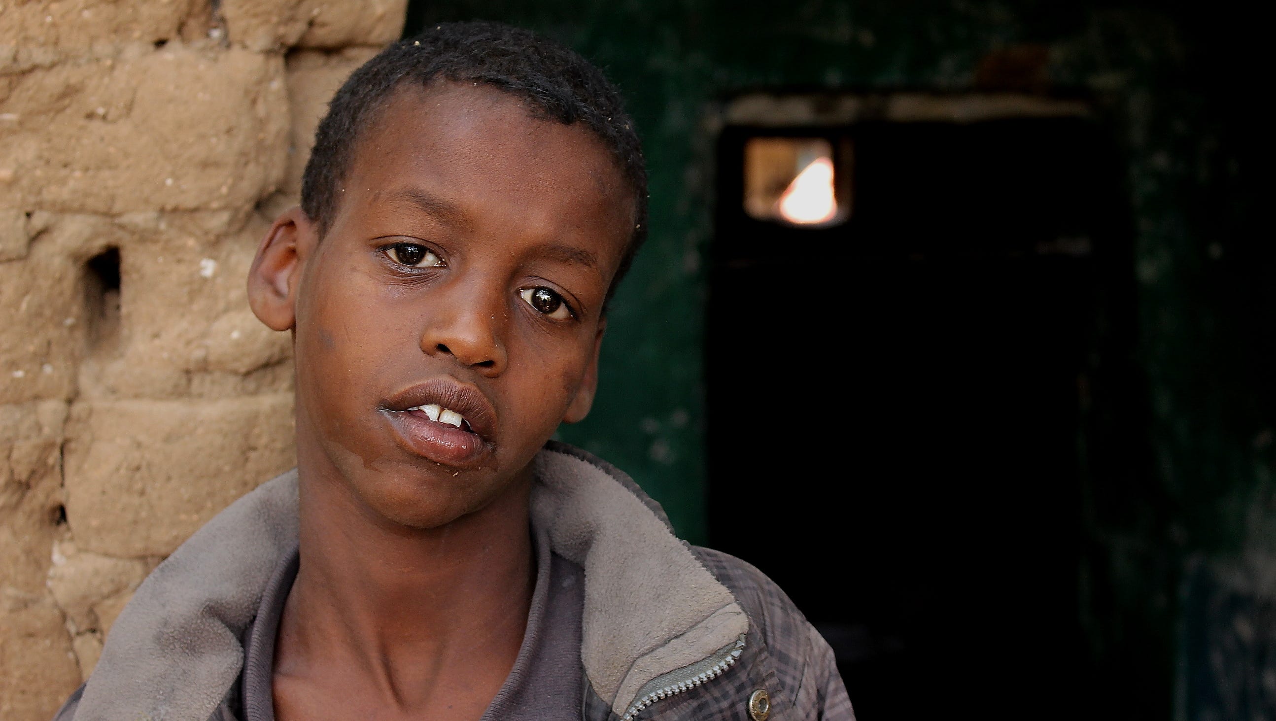 Somalia Cities Number Of Homeless Children Increase Amid Drought