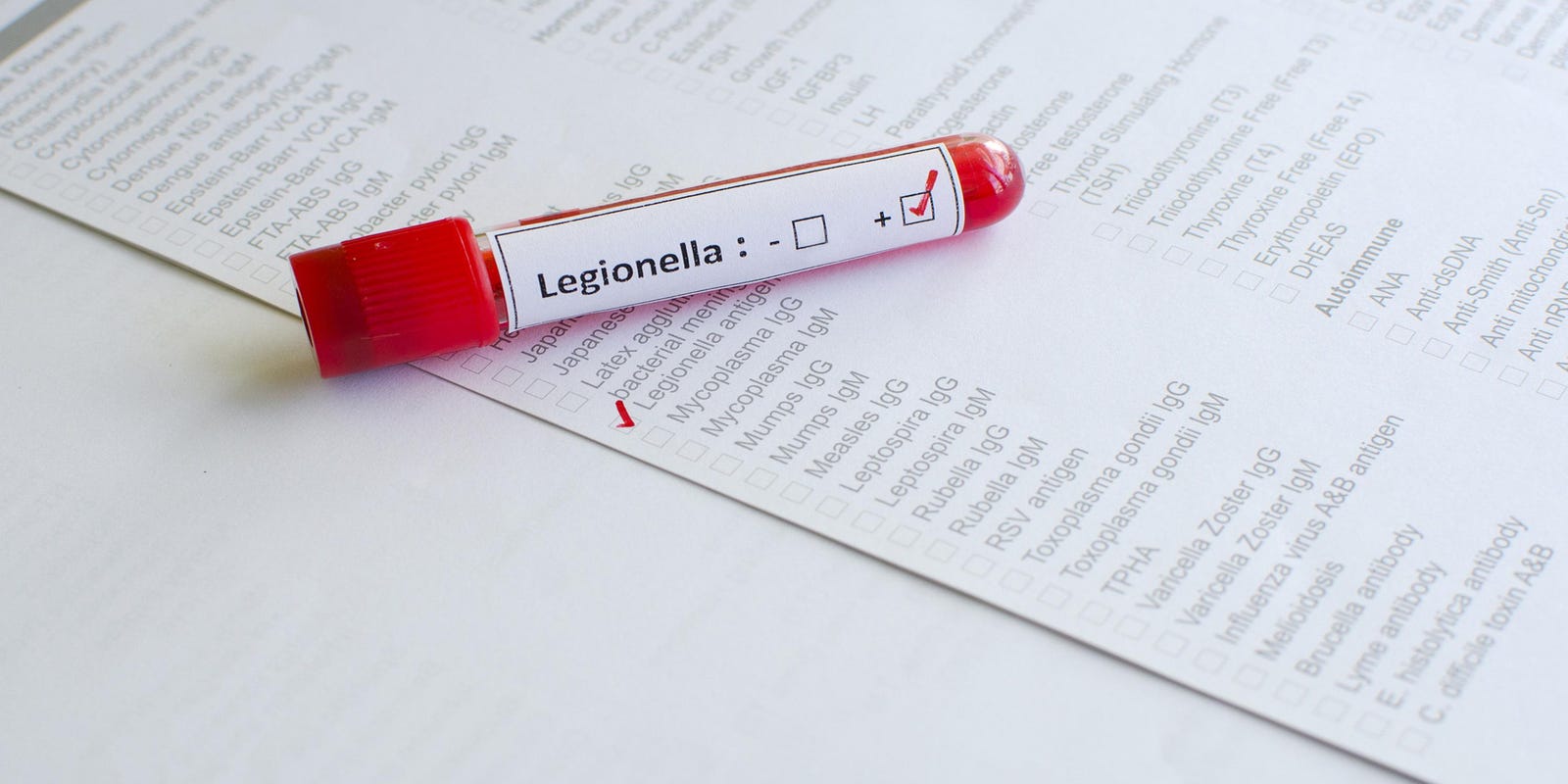 Legionnaires Confirmed In 7 Patients Treated At Mclaren Macomb